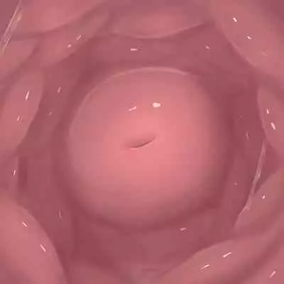 [Purekonkon] Unbirth