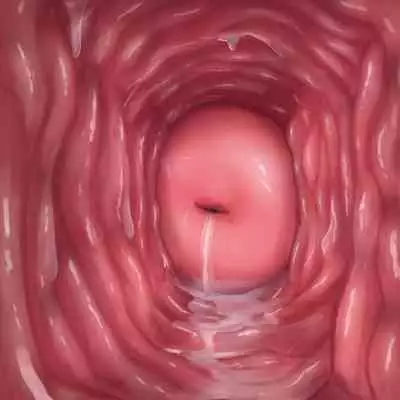 [Purekonkon] Unbirth